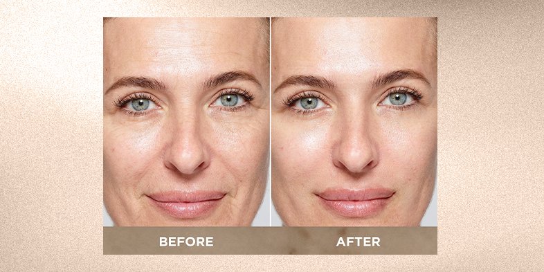 In-Article-what-is-salicylic-acid_2